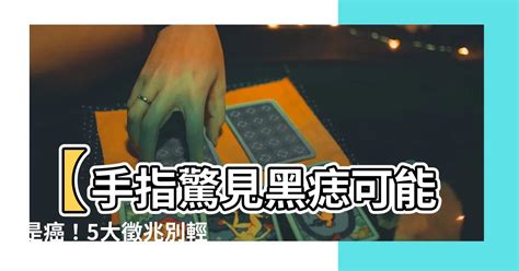 手掌突然長痣|別把癌當痣！5部位冒黑點恐是惡性黑色素瘤 台大醫師。